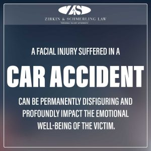 facial injuries