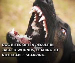 dog bite wounds